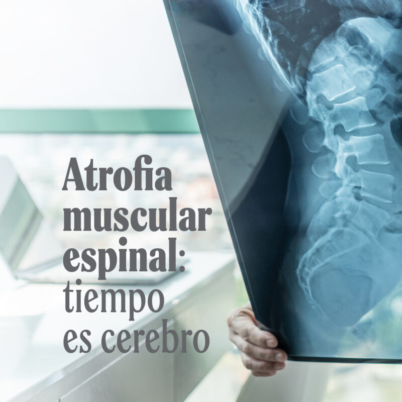 Atrofia muscular espinal: tiempo es cerebro