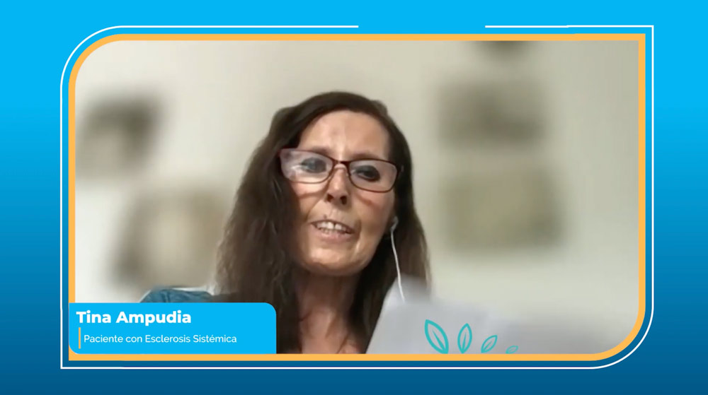 Tina: Paciente con Esclerosis Sistémica
